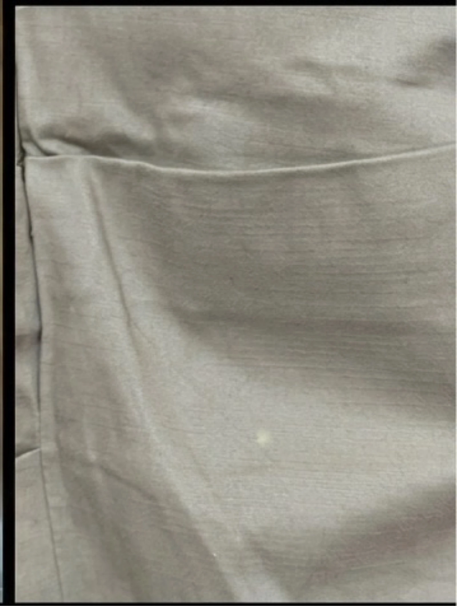 Dress – photo 6